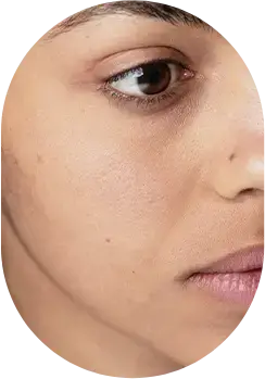 Dull, tired skin lacking radiance.