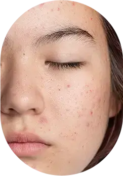 Uneven skin tone and rough texture.
