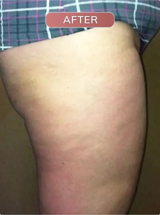 After