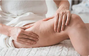 Cellulite Skin