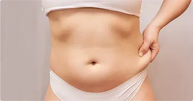 Deep Fat Reduction & Skin Tightening