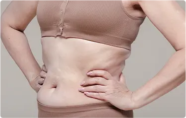 Loose Skin
