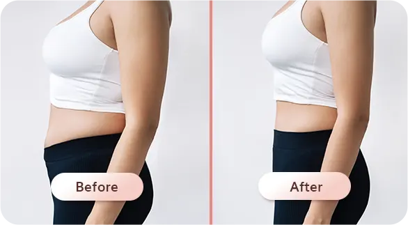 Before/After CFU Ultima