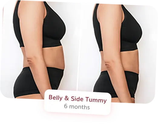Belly and Side Tummy
