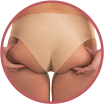 Buttock